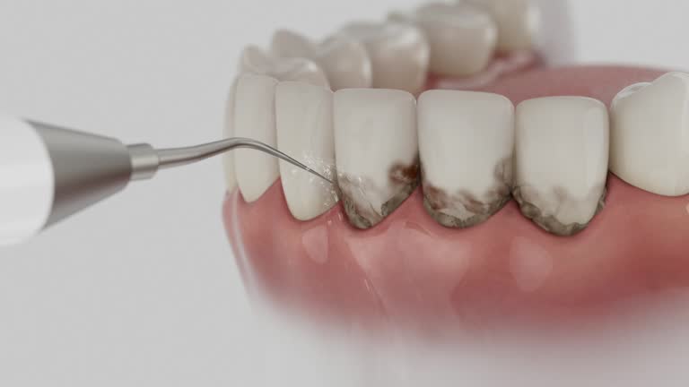 Reliable Dental contractor in Fishers, IN by Dentist Open Now